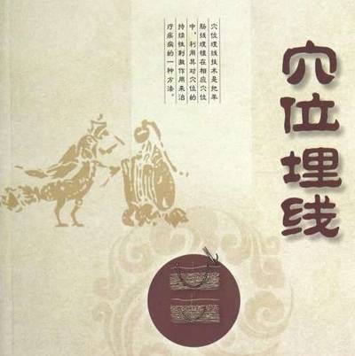穴位埋线(针灸治疗方法)