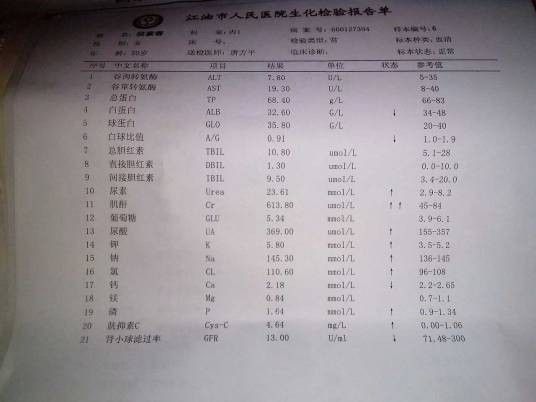 肌酐指数