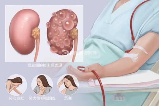 尿毒症(疾病名称)