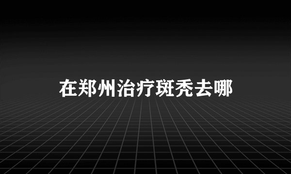 在郑州治疗斑秃去哪