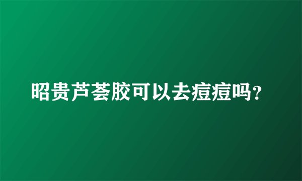 昭贵芦荟胶可以去痘痘吗？