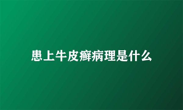 患上牛皮癣病理是什么