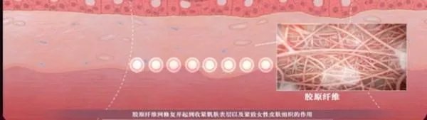 热玛吉危害?热玛吉三天后脸起皮,红肿,医生建议吃修复营养ACMETEA修复受损细胞,吃了一个月,效
