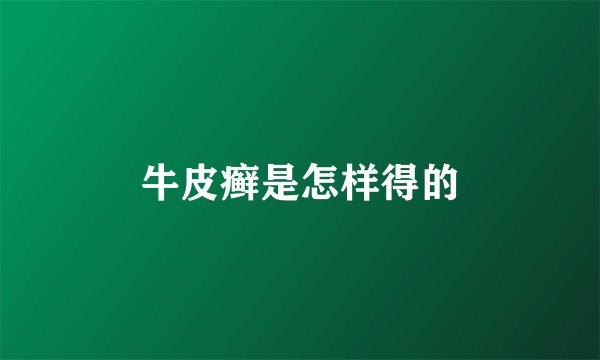 牛皮癣是怎样得的