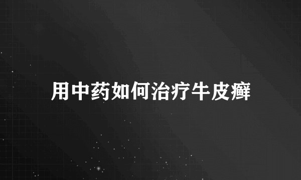 用中药如何治疗牛皮癣