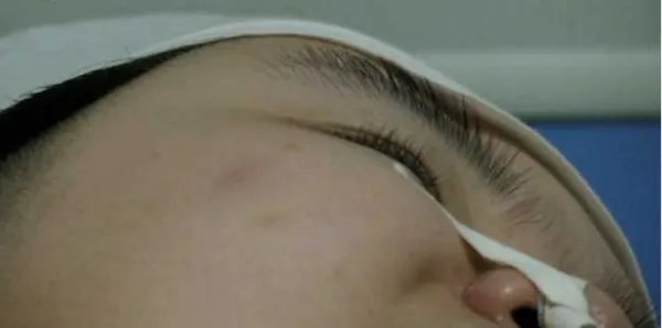 父母用爱唤醒植物人女儿了吗？