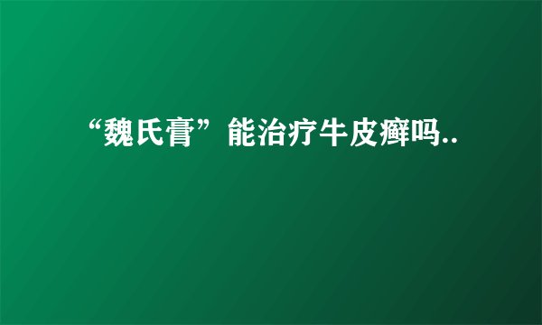 “魏氏膏”能治疗牛皮癣吗..