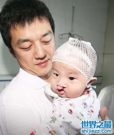 王菲李亚鹏女儿李嫣照片,天生唇腭裂却自信可爱