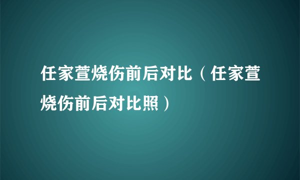 任家萱烧伤前后对比（任家萱烧伤前后对比照）