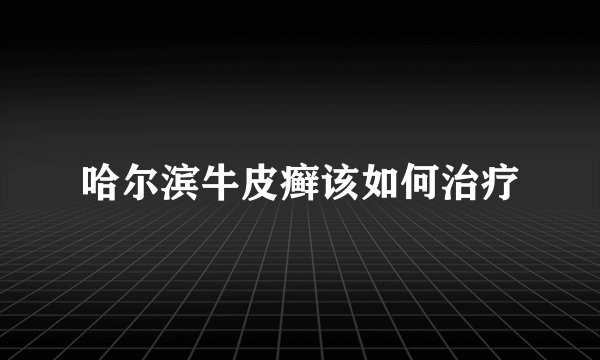 哈尔滨牛皮癣该如何治疗