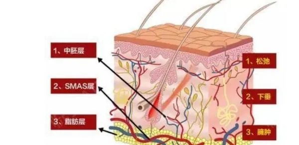 热玛吉危害?热玛吉三天后脸起皮,红肿,医生建议吃修复营养ACMETEA修复受损细胞,吃了一个月,效