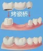 斯嘉丽 约翰逊种子