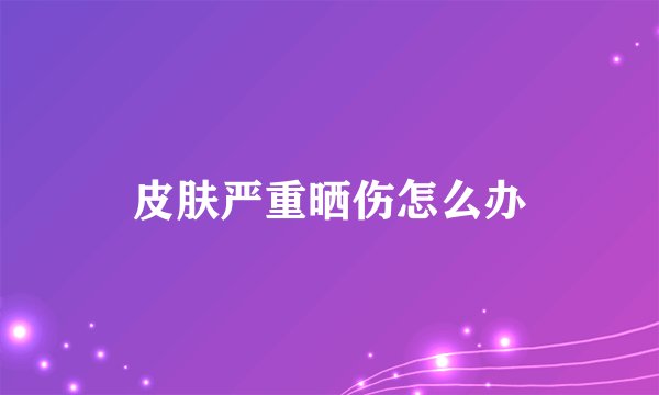 皮肤严重晒伤怎么办