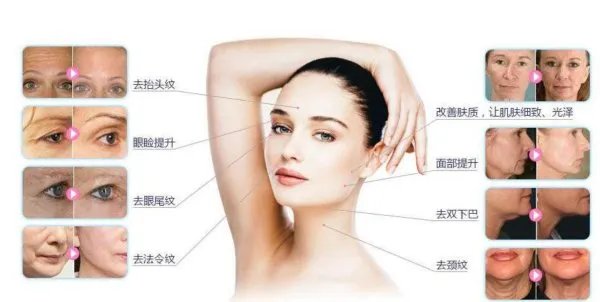 热玛吉危害?热玛吉三天后脸起皮,红肿,医生建议吃修复营养ACMETEA修复受损细胞,吃了一个月,效