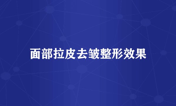 面部拉皮去皱整形效果