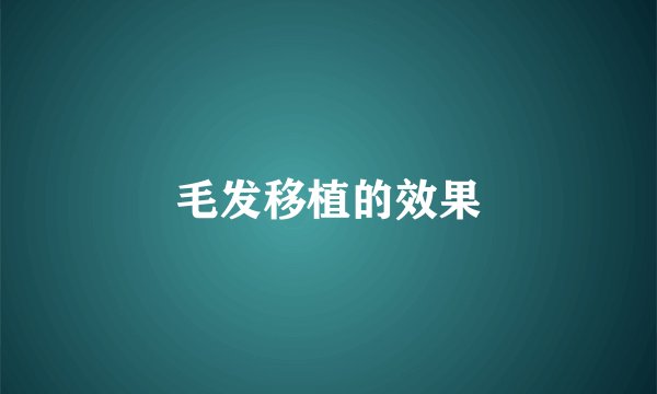 毛发移植的效果
