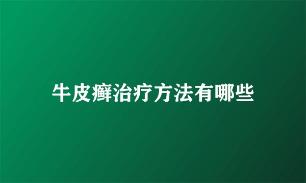 牛皮癣治疗方法有哪些