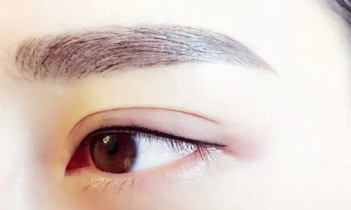 北京开内眼角手术怎么样
