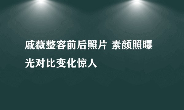 戚薇整容前后照片 素颜照曝光对比变化惊人