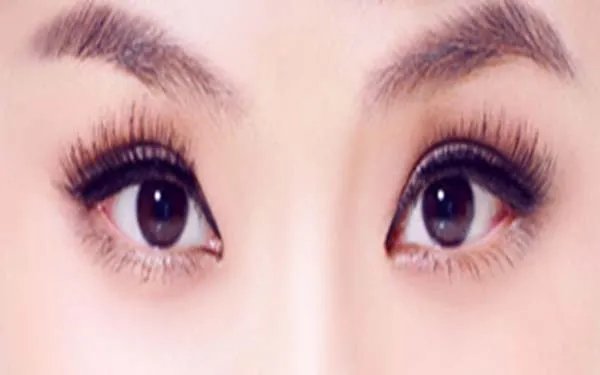 北京开眼角哪个医院好?
