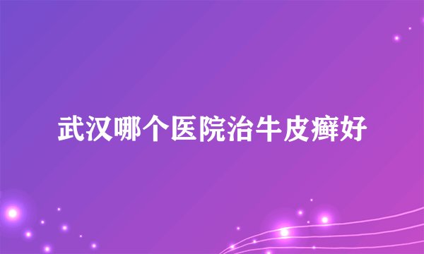 武汉哪个医院治牛皮癣好