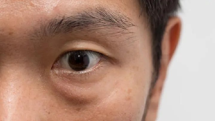 眼球震颤应如何治疗