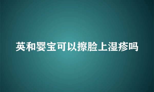 英和婴宝可以擦脸上湿疹吗
