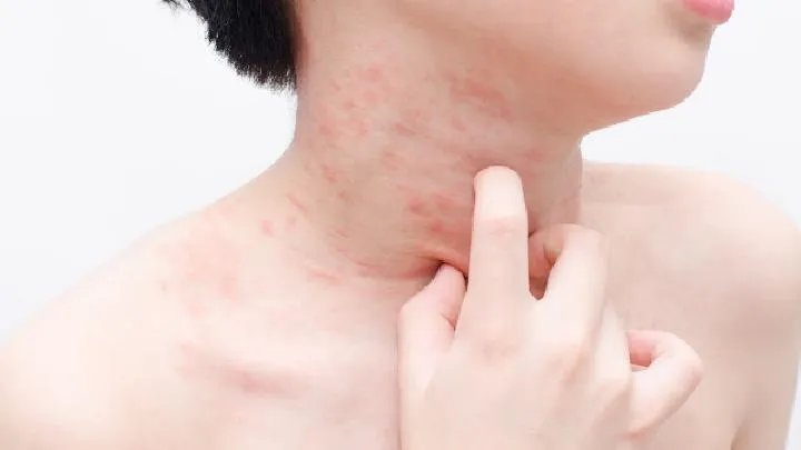 治疗鱼鳞病最好医院是哪家?