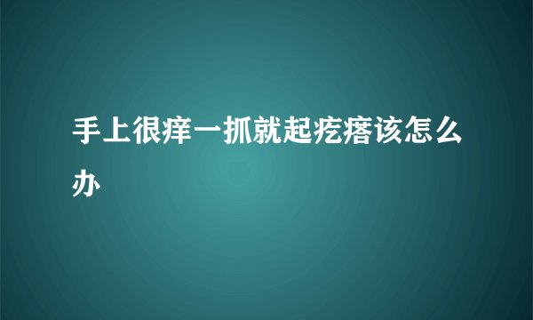 手上很痒一抓就起疙瘩该怎么办