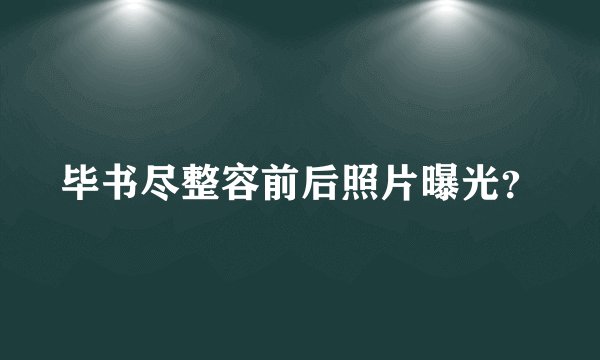 毕书尽整容前后照片曝光？