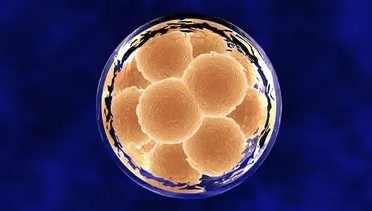 代生宝宝-吉林母猪产下“小象”:鼻子长近4厘米