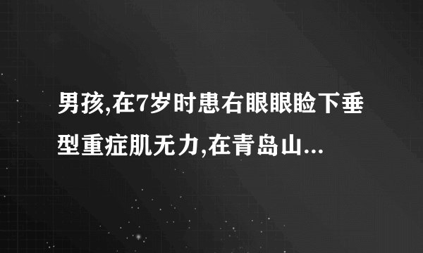 男孩,在7岁时患右眼眼睑下垂型重症肌无力,在青岛山大医院治疗