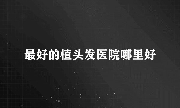 最好的植头发医院哪里好