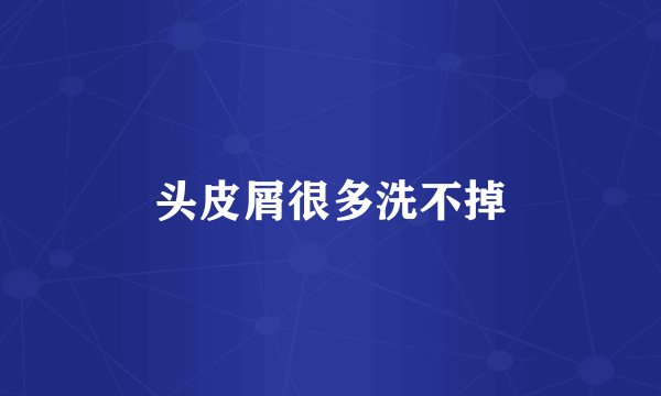 头皮屑很多洗不掉