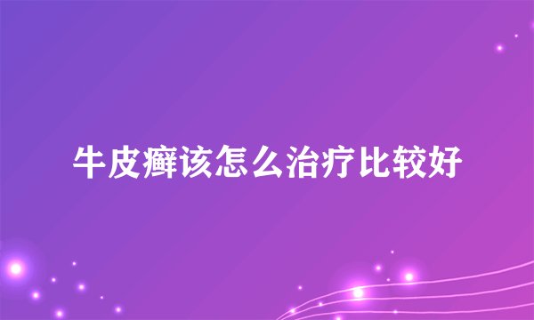 牛皮癣该怎么治疗比较好