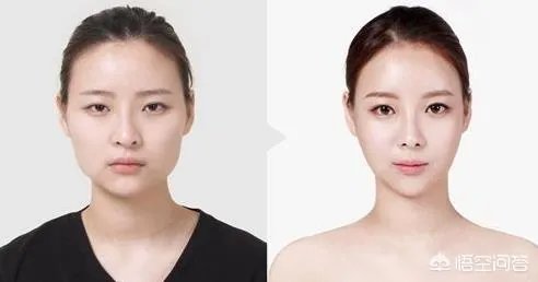赴韩整容失败，各位怎么看？