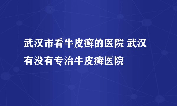 武汉市看牛皮癣的医院 武汉有没有专治牛皮癣医院