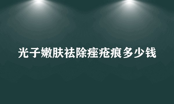 光子嫩肤祛除痤疮痕多少钱
