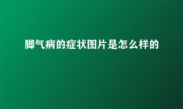 脚气病的症状图片是怎么样的