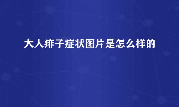 大人痱子症状图片是怎么样的