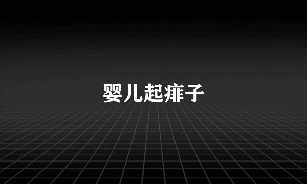 婴儿起痱子