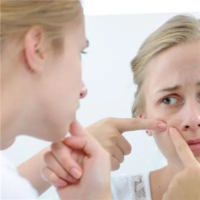 怎么痤疮哪里治疗的比较好呢