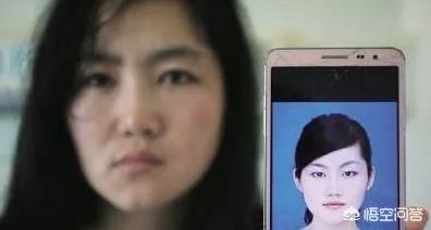 赴韩整容失败，各位怎么看？