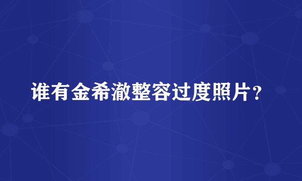 谁有金希澈整容过度照片？