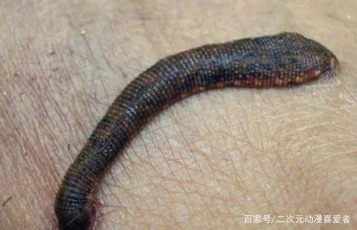 活体蚂蟥在5岁男孩体内存留1年多,体内有蚂蟥会有哪些症状?