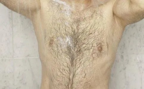 医院全身脱毛大概多少钱