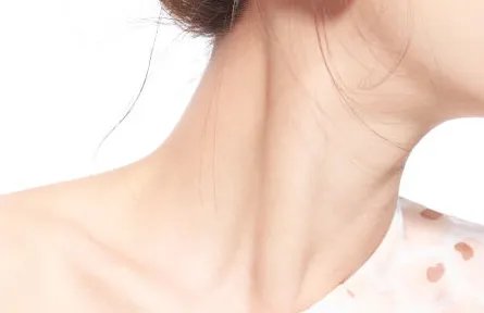 怎么去颈部皱纹