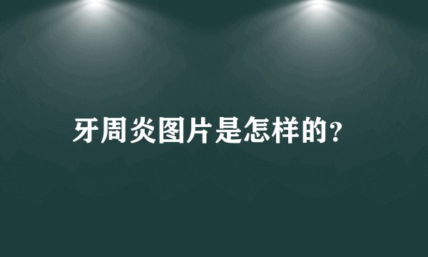 牙周炎图片是怎样的?