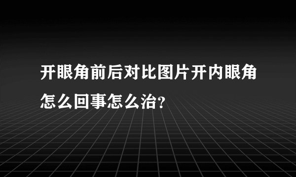 开眼角前后对比图片开内眼角怎么回事怎么治？