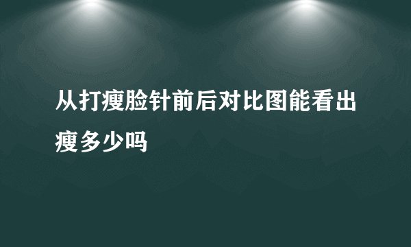 从打瘦脸针前后对比图能看出瘦多少吗